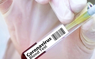Urzędnicy z Giżycka przeszli testy na obecność przeciwciał wirusa SARS-CoV-2. Znamy wyniki badań ponad 200 osób